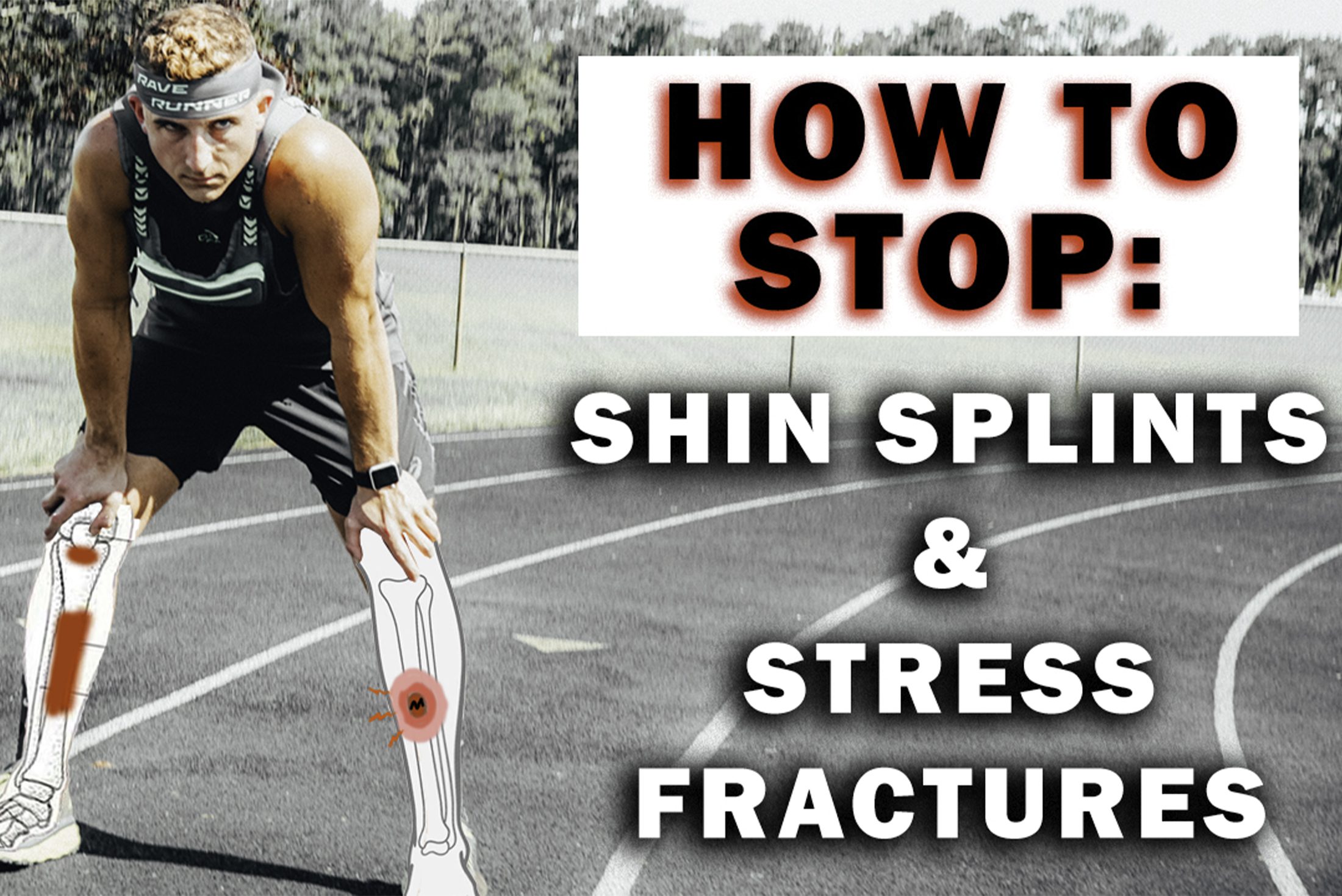 how to prevent shin splints and stress fractures